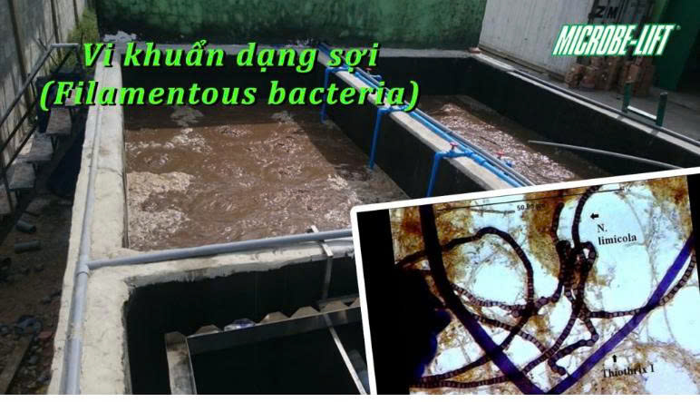 Vi khuẩn dạng sợi
